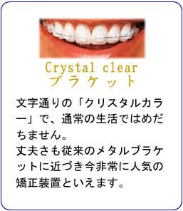 Crystal clear ブラケット